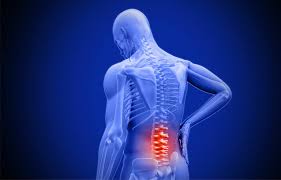Back pain physiotherapy treatment at BSM Neuro Rehab Hospital