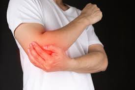 Tennis elbow treatment at BSM Neuro Rehab Hospital, Jaipur
